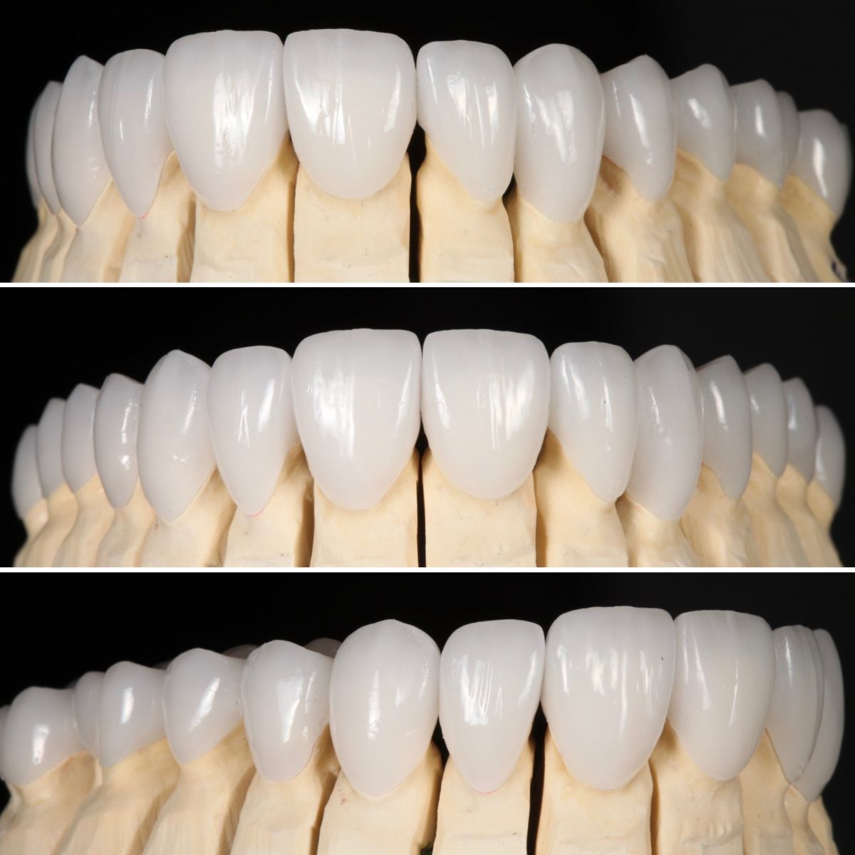 Practice Philosophy Strupp & Brumm Cosmetic & Restorative Dentistry